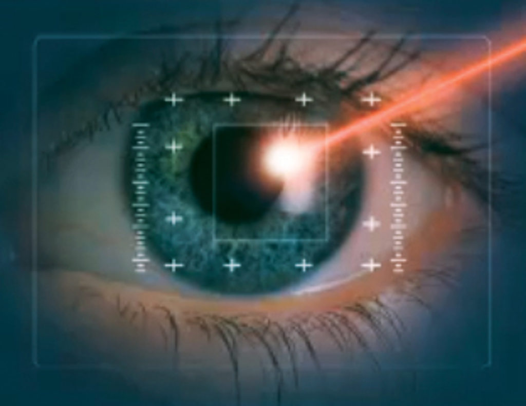 On-Site Cataract & Laser Center