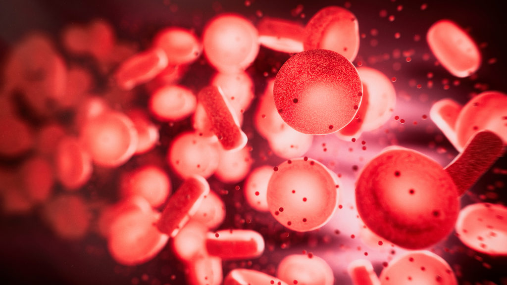 Sepsis 