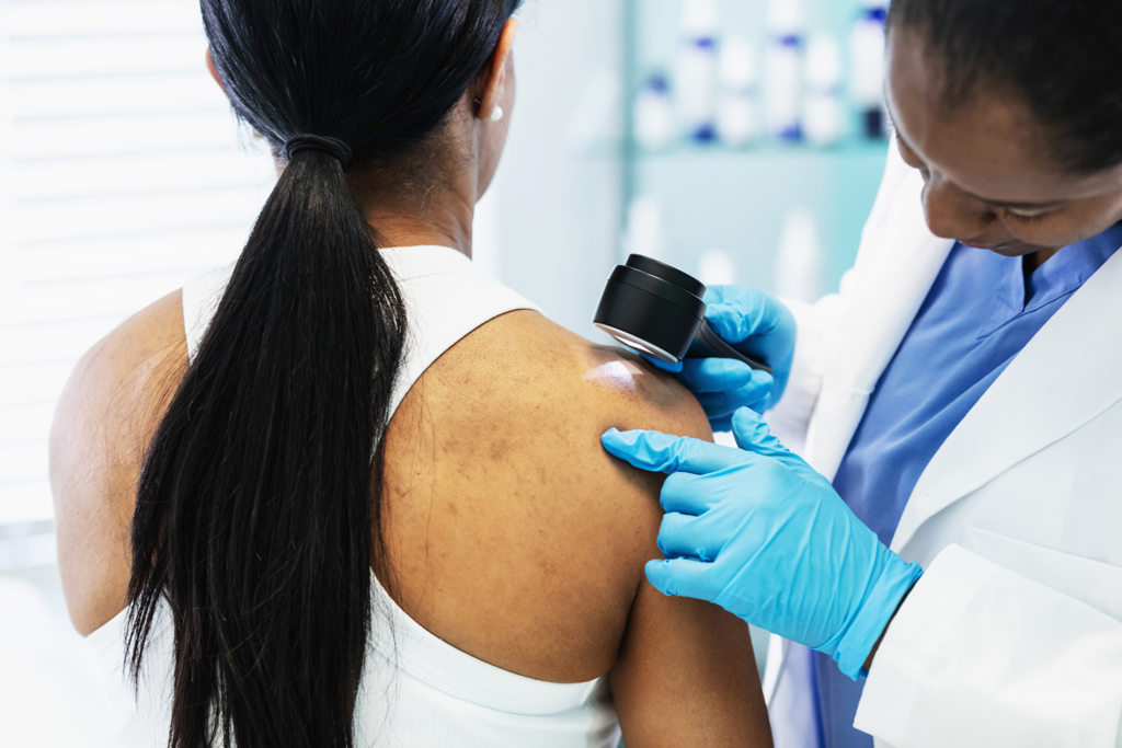 Skin Cancer Treatment 