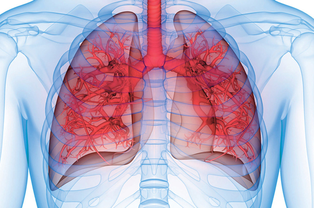 Lung Surgery at Penn Highlands Healthcare