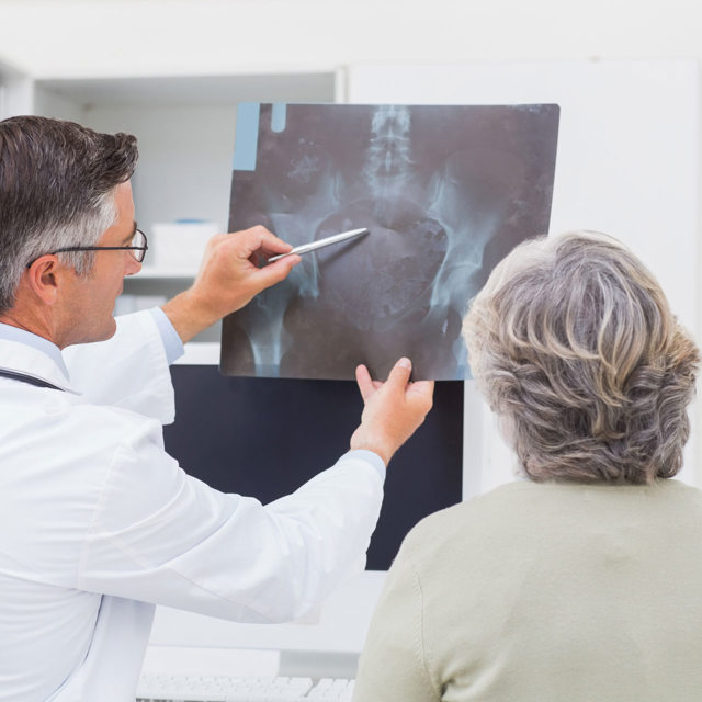 Joint Replacement Program
